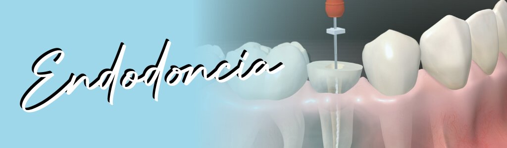 Endodoncista CDMX